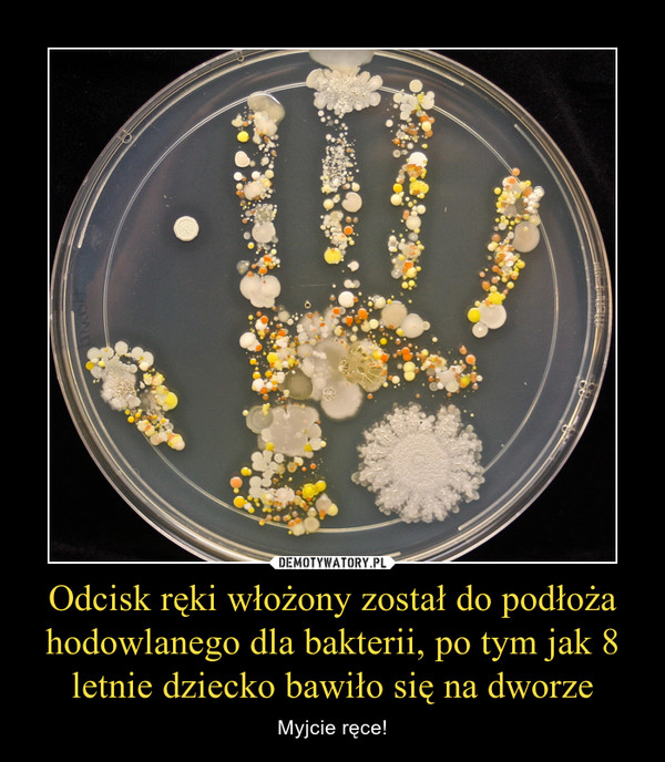 Odcisk ręki włożony został do podłoża hodowlanego dla bakterii, po tym jak 8 letnie dziecko bawiło się na dworze – Myjcie ręce! 