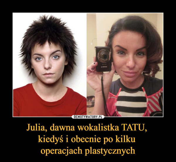 Julia, dawna wokalistka TATU, kiedyś i obecnie po kilku operacjach plastycznych –  