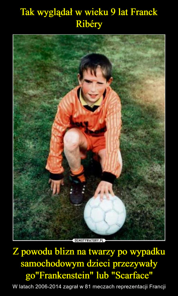 Tak wyglądał w wieku 9 lat Franck Ribéry Z powodu blizn na twarzy po wypadku samochodowym dzieci przezywały go"Frankenstein" lub "Scarface"