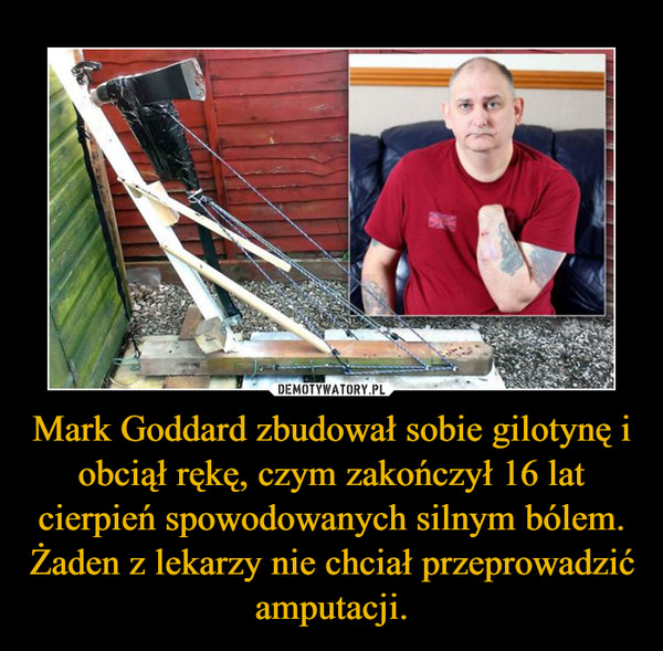 Mark Goddard zbudował sobie gilotynę i obciął rękę, czym zakończył 16 lat cierpień spowodowanych silnym bólem. Żaden z lekarzy nie chciał przeprowadzić amputacji.