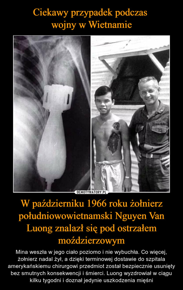 W październiku 1966 roku żołnierz południowowietnamski Nguyen Van Luong znalazł się pod ostrzałem moździerzowym – Mina weszła w jego ciało poziomo i nie wybuchła. Co więcej, żołnierz nadal żył, a dzięki terminowej dostawie do szpitala amerykańskiemu chirurgowi przedmiot został bezpiecznie usunięty bez smutnych konsekwencji i śmierci. Luong wyzdrowiał w ciągu kilku tygodni i doznał jedynie uszkodzenia mięśni 