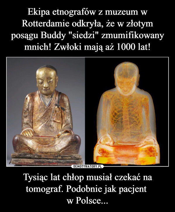 Ekipa etnografów z muzeum w Rotterdamie odkryła, że w złotym posągu Buddy "siedzi" zmumifikowany mnich! Zwłoki mają aż 1000 lat! Tysiąc lat chłop musiał czekać na tomograf. Podobnie jak pacjent 
w Polsce...